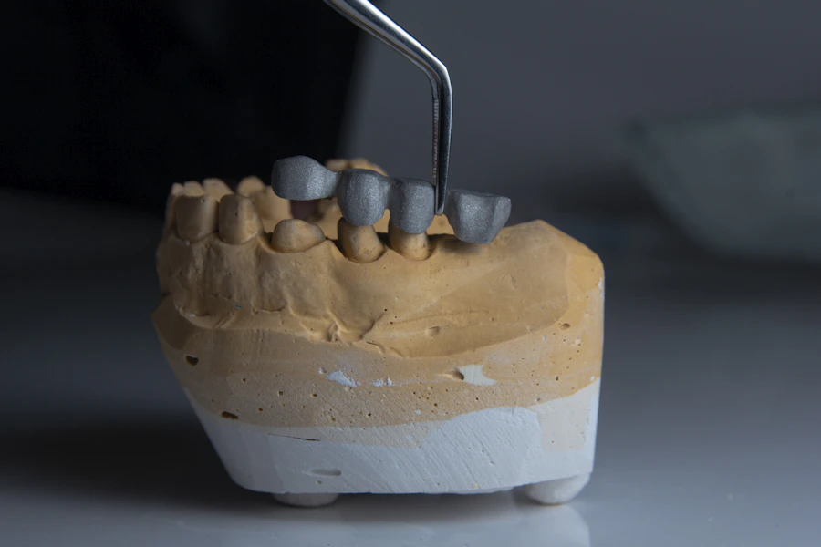 Alçı model üzerinde tam seramik kaplama restorasyonları